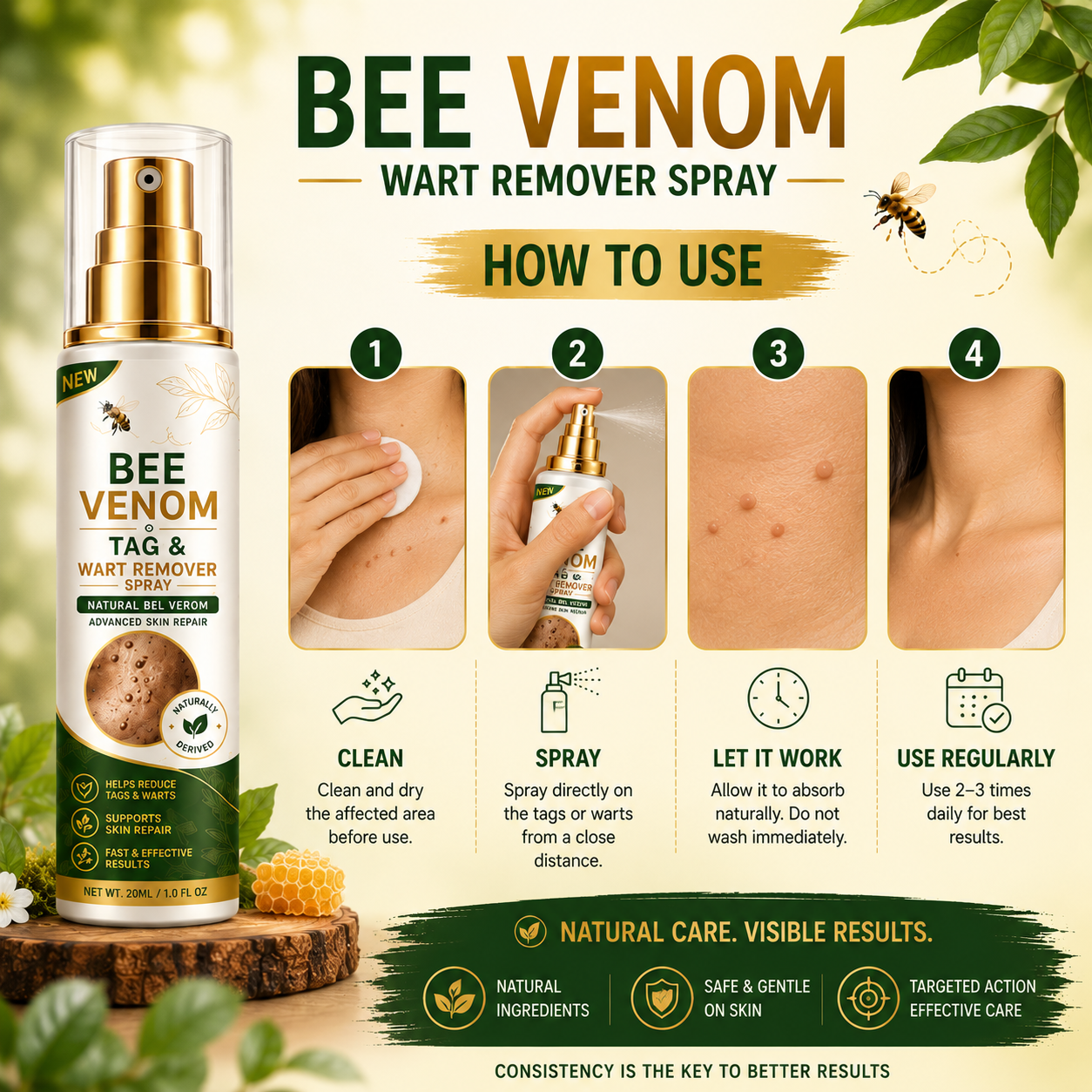 MDY Bee Venom Tag & Wart Remover Spray - Remove Skin Tags & Warts Without Pain – Get Smooth Looking Skin Again