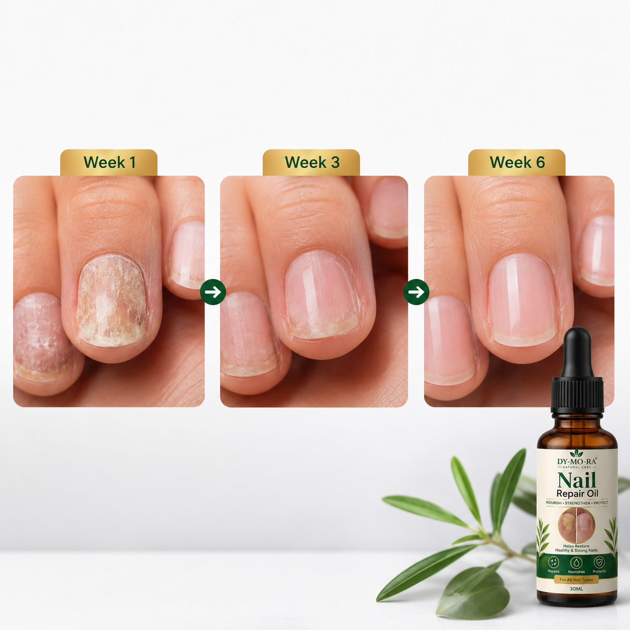 MDY Herbal Nail Repair Oil for Weak, Brittle & Damaged Nails — Trusted Daily Care for Fingernails & Toenails