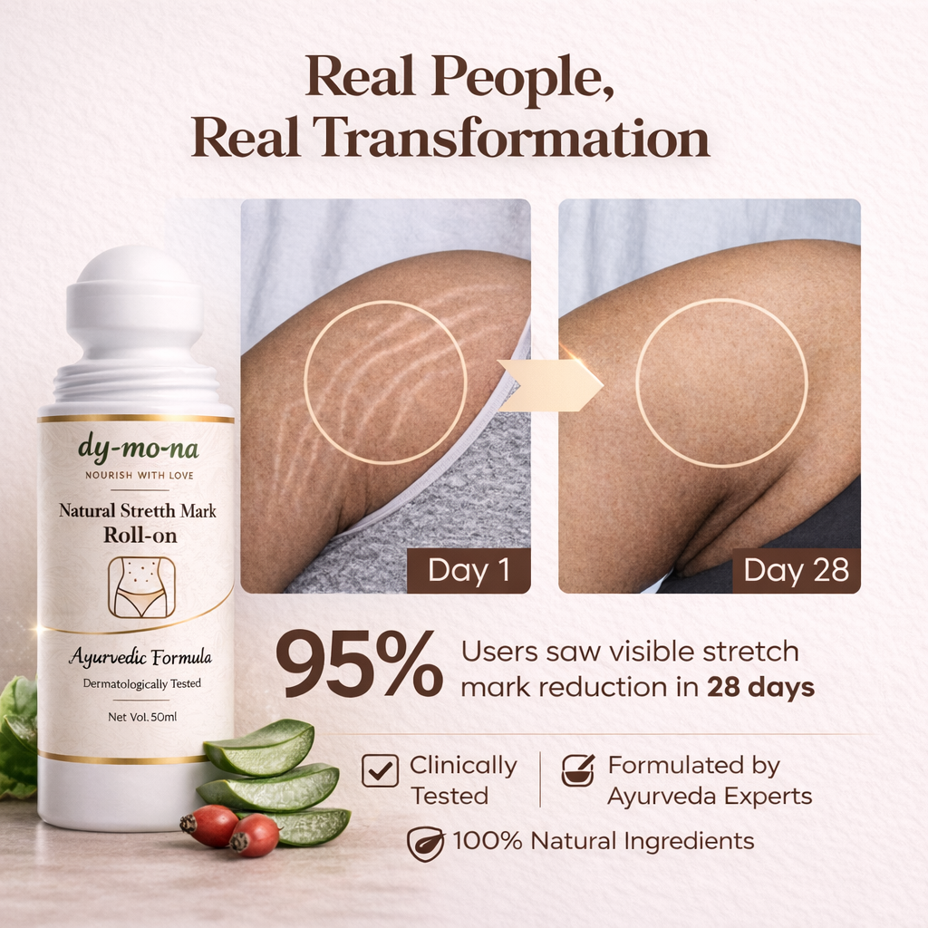 MDY Natural Stretch Mark Roll-On | Ayurvedic Skin Repair Formula