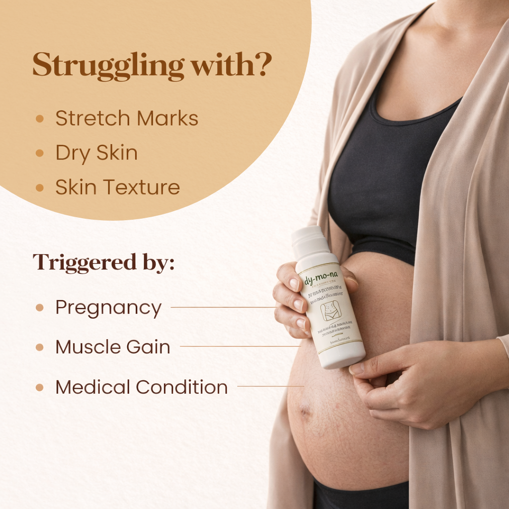 MDY Natural Stretch Mark Roll-On | Ayurvedic Skin Repair Formula
