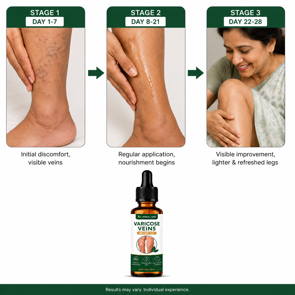 MDY 🦵 Tired of visible veins and leg discomfort ?  Turmeric Varicose Vein Patch Today (Copy)