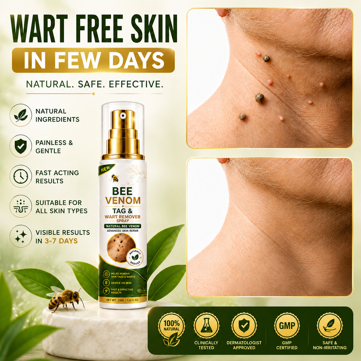 MDY Bee Venom Tag & Wart Remover Spray - Remove Skin Tags & Warts Without Pain – Get Smooth Looking Skin Again