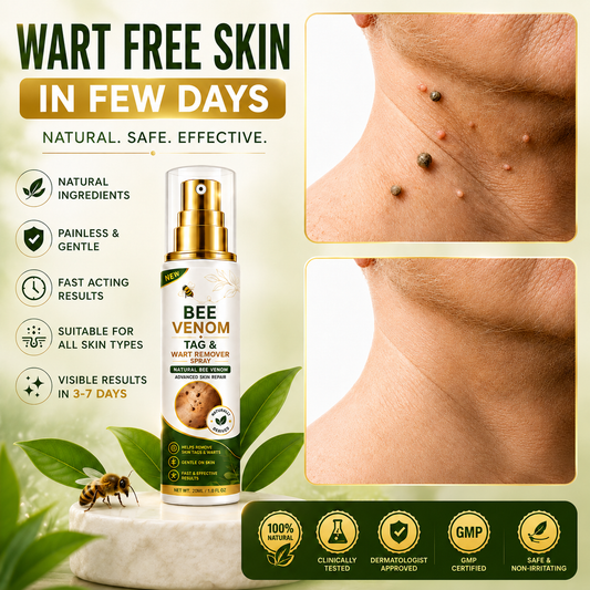 MDY Bee Venom Tag & Wart Remover Spray - Remove Skin Tags & Warts Without Pain – Get Smooth Looking Skin Again