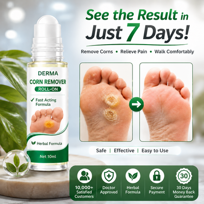 MDY Corn Remover Roll-On – Herbal Roll-On for Hard Corns & Rough Feet | Fast Acting Formula