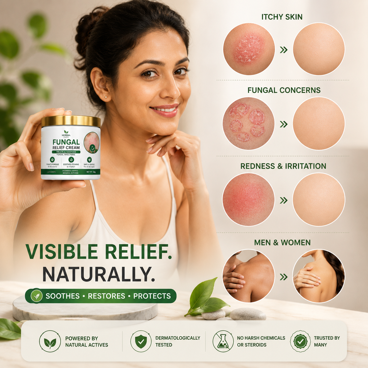 MDY Herbal Care Fungal Relief Cream  Soothing Herbal Relief for Itchy, Irritated Skin