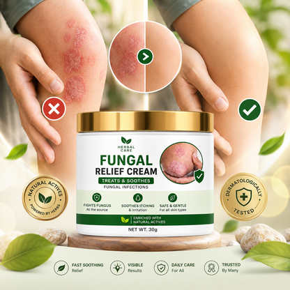 MDY Herbal Care Fungal Relief Cream  Soothing Herbal Relief for Itchy, Irritated Skin