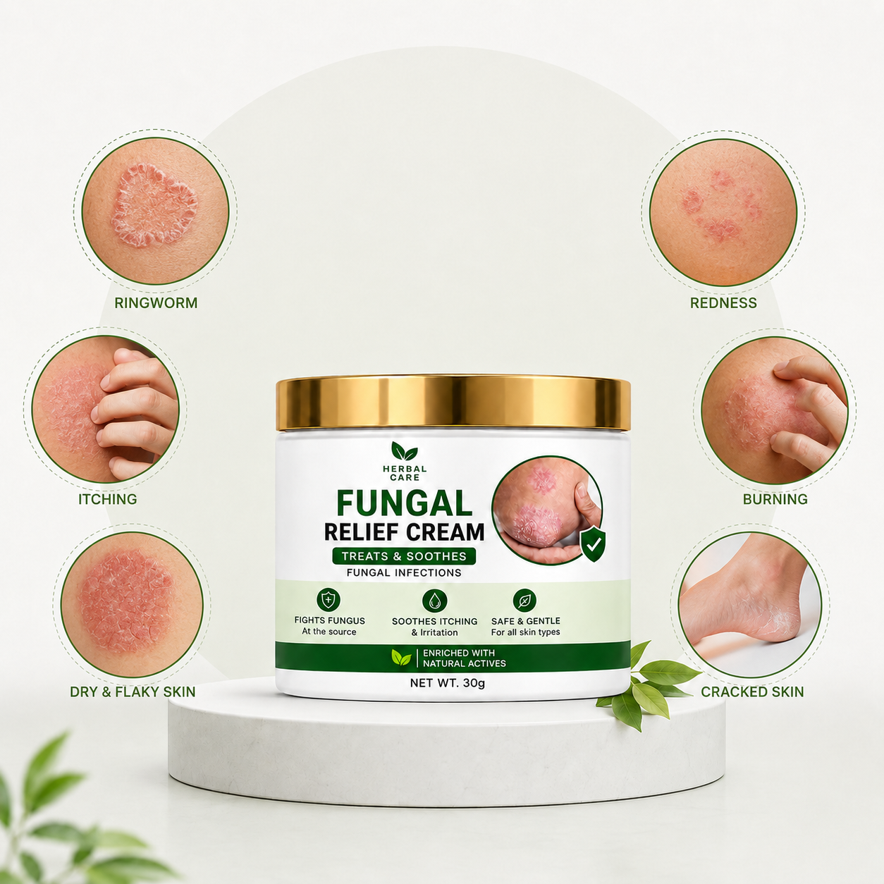 MDY Herbal Care Fungal Relief Cream  Soothing Herbal Relief for Itchy, Irritated Skin