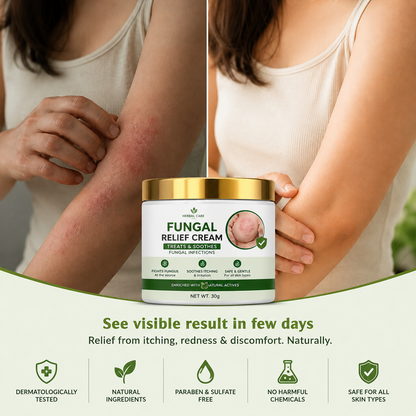 MDY Herbal Care Fungal Relief Cream  Soothing Herbal Relief for Itchy, Irritated Skin