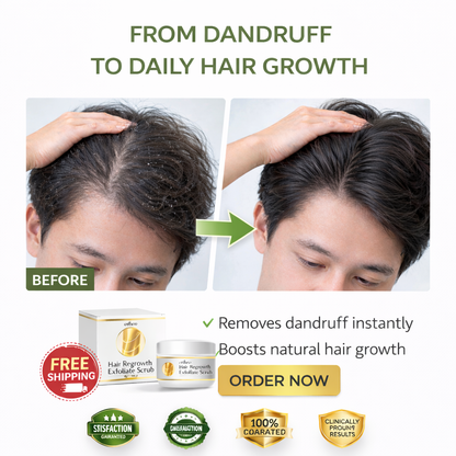Hair Regrowth Exfoliate Scrub by Eelhoe