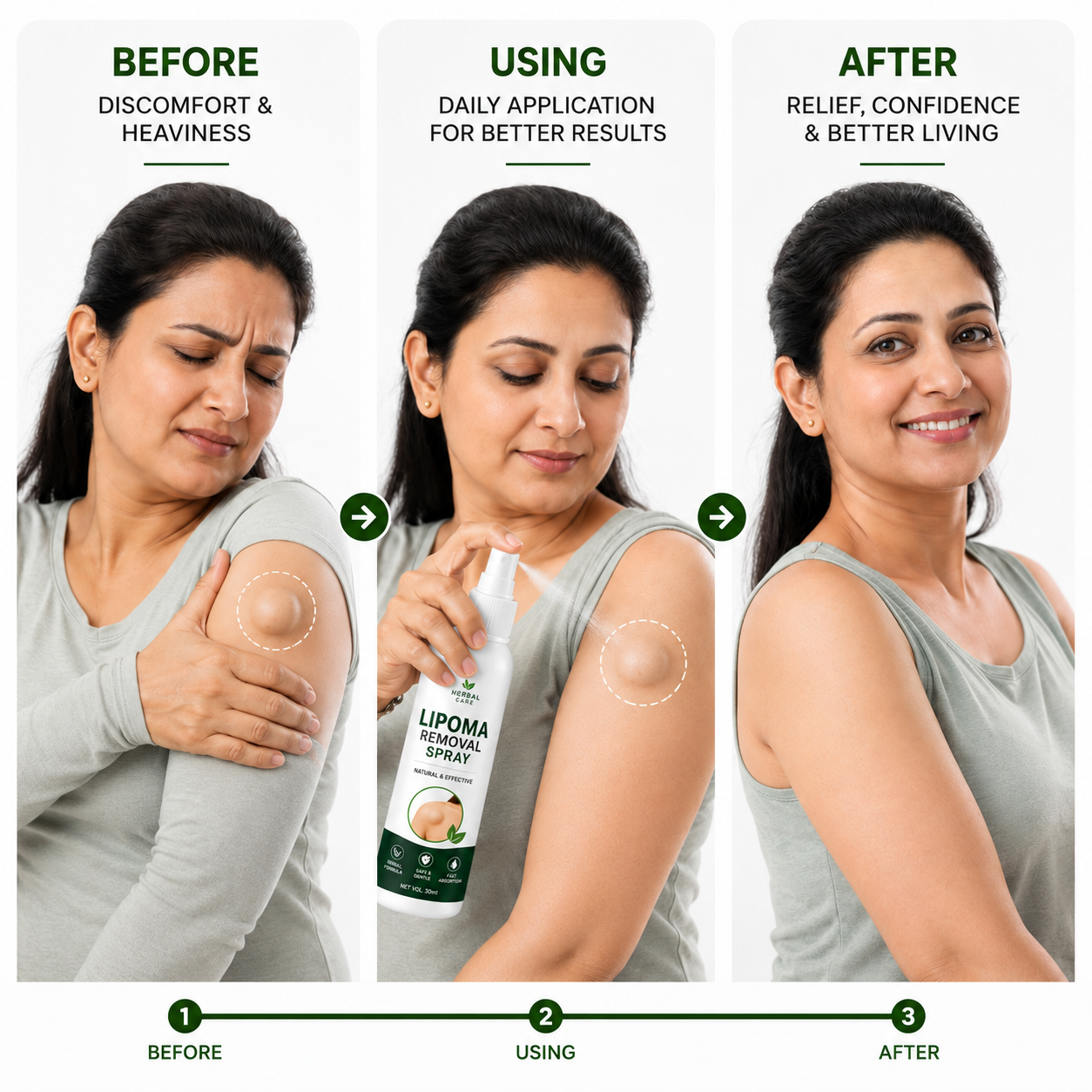 🎯 Lipoma Removal Spray – Target The Appearance Of Lipoma Bumps With Daily Care