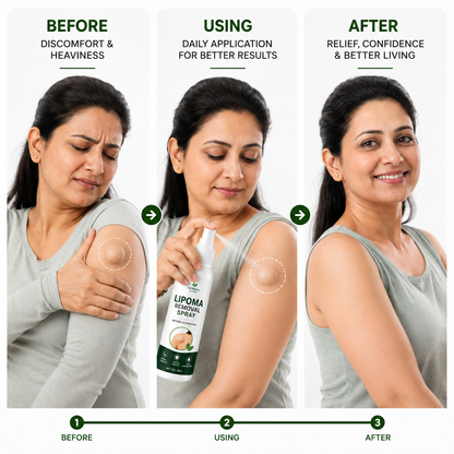 🎯 Lipoma Removal Spray – Target The Appearance Of Lipoma Bumps With Daily Care