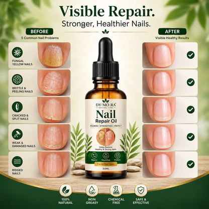 MDY Herbal Nail Repair Oil for Weak, Brittle & Damaged Nails — Trusted Daily Care for Fingernails & Toenails