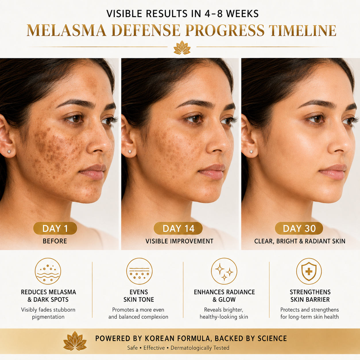 MDY Korean Advanced Melasma Defense Cream — See Visible Brightening in 4–8 Weeks
