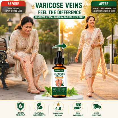 MDY 🦵 Tired of visible veins and leg discomfort ?  Turmeric Varicose Vein Patch Today (Copy)