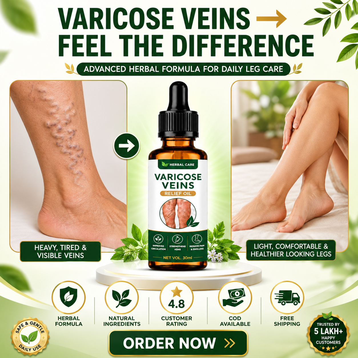 MDY 🦵 Tired of visible veins and leg discomfort ?  Turmeric Varicose Vein Patch Today (Copy)