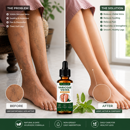 MDY 🦵 Tired of visible veins and leg discomfort ?  Turmeric Varicose Vein Patch Today (Copy)